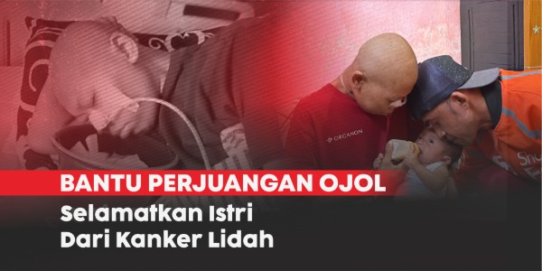 URGENT! OJOL MENGHADAPI ISTRI SAKIT TONGUE CANCER