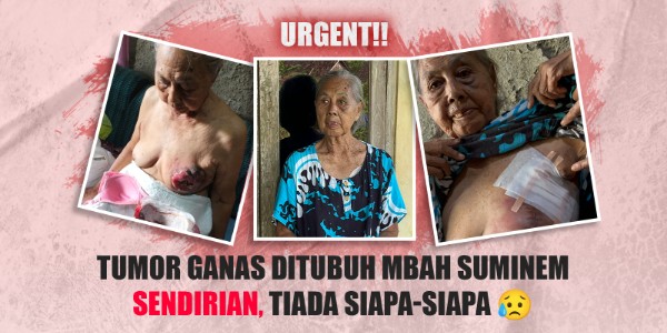 Hidup Sebatang Kara Tanpa Keluarga, Mbah Suminem Idap Tumor Payudara Ganas