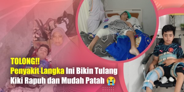 Bantu Kiki! Kemo Bulan Ini Terancam Tertunda karena Biaya