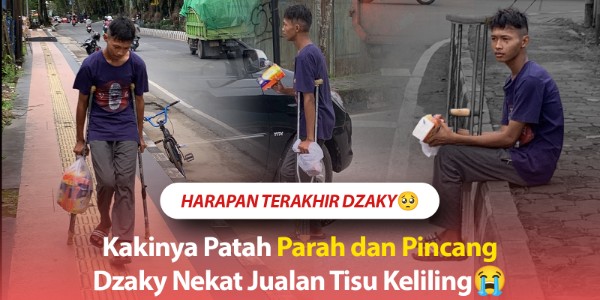Dzaky Penjual Tisu Berjuang Dengan Kaki Pincang
