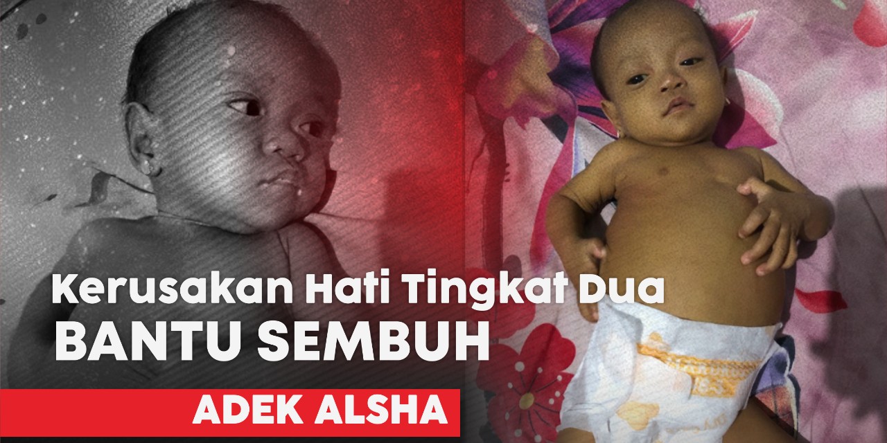 Alshamira Berjuang Melawan Kerusakan Hati: Transplantasi Jadi Harapan Terakhir